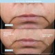 دستگاه لیفتینگ صورت نوفیس مدل Facial Toning دستگاه لیفتینگ صورت نوفیس مدل Facial Toning