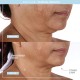 دستگاه لیفتینگ صورت نوفیس مدل Facial Toning دستگاه لیفتینگ صورت نوفیس مدل Facial Toning