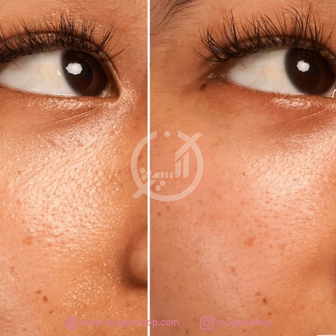 سرم کوچک کننده منافذ گلورسپی مدل Strawberry BHA سرم کوچک کننده منافذ گلورسپی مدل Strawberry BHA