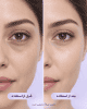 کرم دور چشم حجمدهنده رتینال +NAD شماره 9 نامبوزین کرم دور چشم حجمدهنده رتینال +NAD شماره 9 نامبوزین