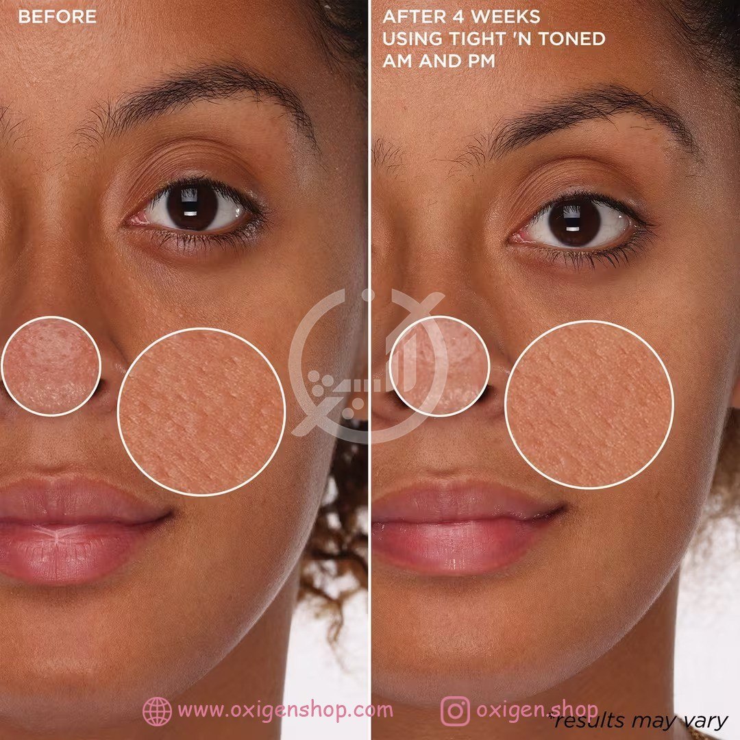 تونر فومی بنفیت مدل Tight ’n Toned تونر فومی بنفیت مدل Tight ’n Toned